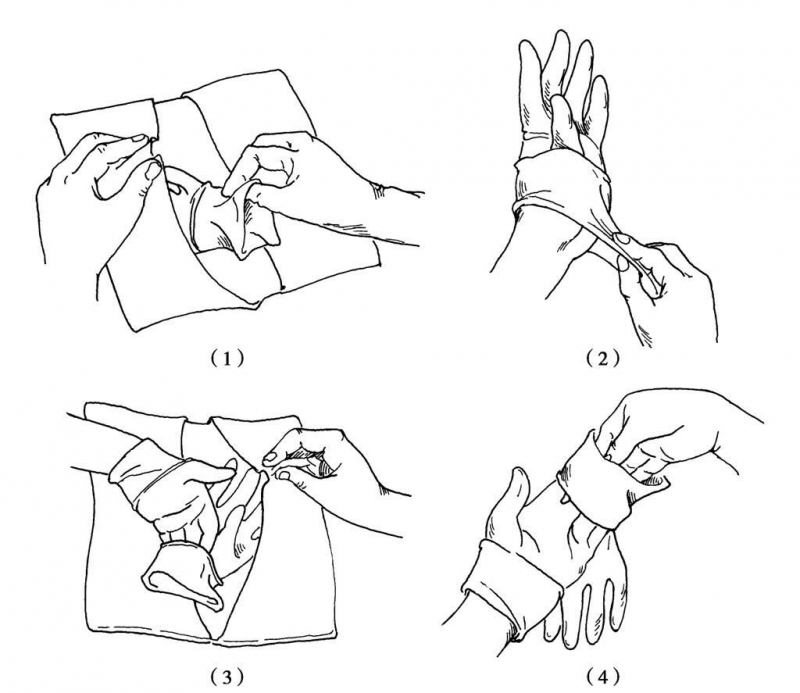 脱无菌手术衣的步骤图图片